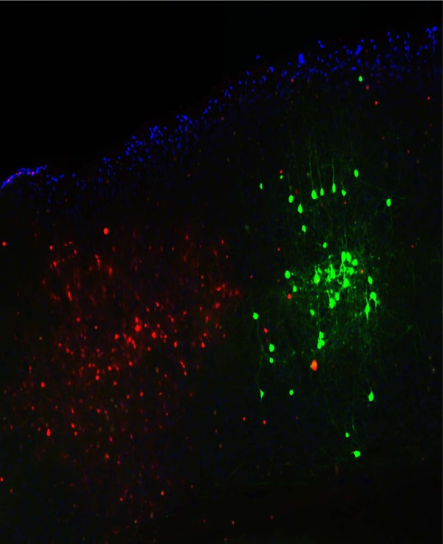 형광물질을 발현시킨 뇌 절편 영상에서의 신경세포의 분포